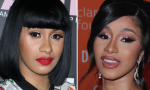 Cardi B before and after plastic surgery.